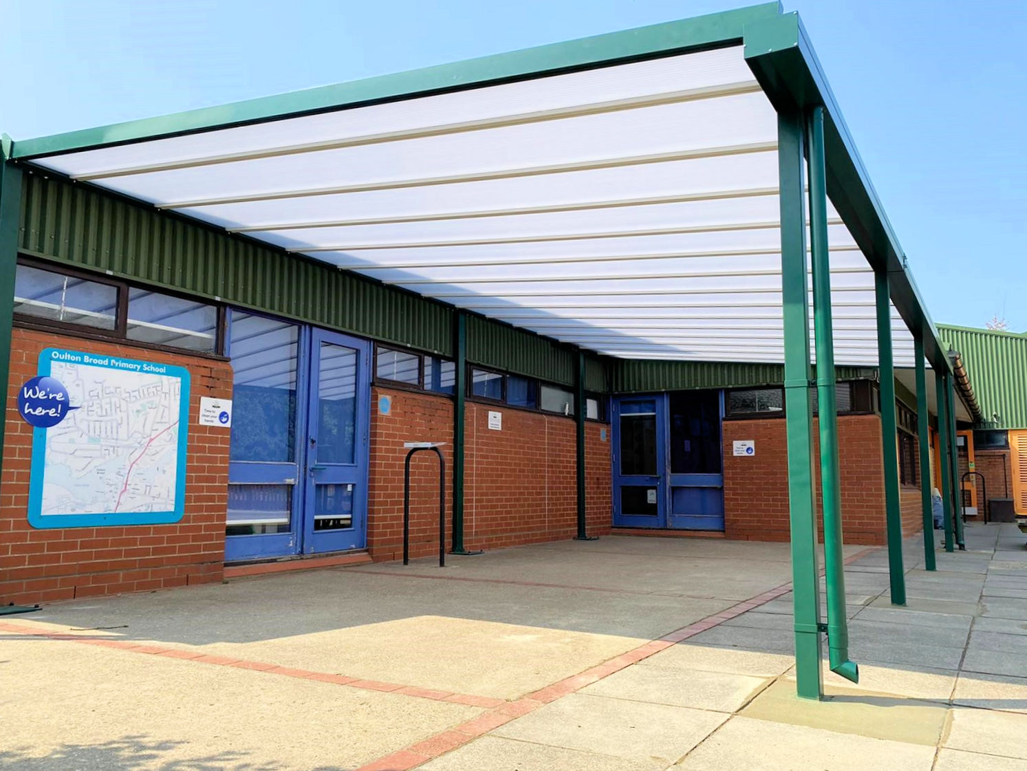 Should Cost Affect Your Canopy Choice? Able Canopies